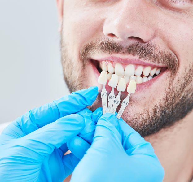 estetica dentale | Studio Bernardi Odontoiatri Bologna